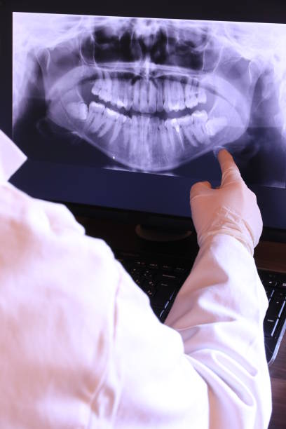 Best Emergency Root Canal Therapy in Williamsport, PA