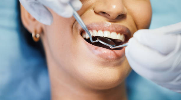 Best Emergency Treatment for Oral Infections in Williamsport, PA